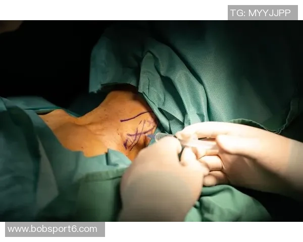 广西外援阿萨莫阿助行器辅助下成功下床行走传来好消息